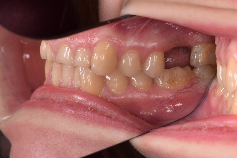 Moorside Dental